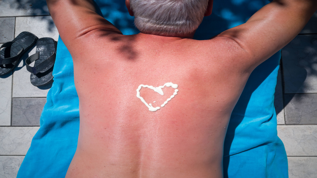 Person liegt auf dem Bauch, auf dem Rücken Sonnenbrand und ein Herz aus Sonnenmilch.