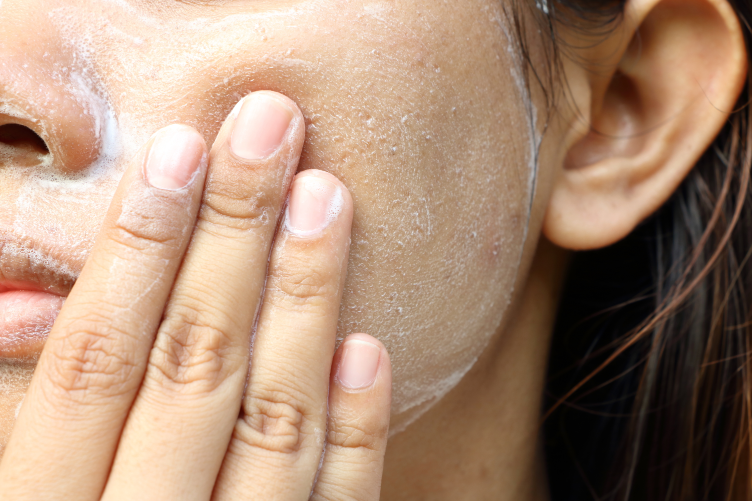 Um Pickelmale zu entfernen, kannst du regelmÃ¤ÃŸig eine Maske aus Joghurt und Zitronensaft auftragen.